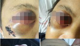 快訊 | 華潤水泥分廠發(fā)生事故?。ǜ綀D）